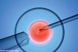 男科专家